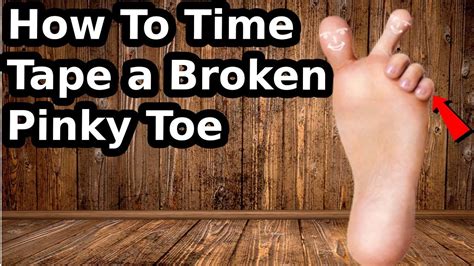 how to deal with a stubbed toe